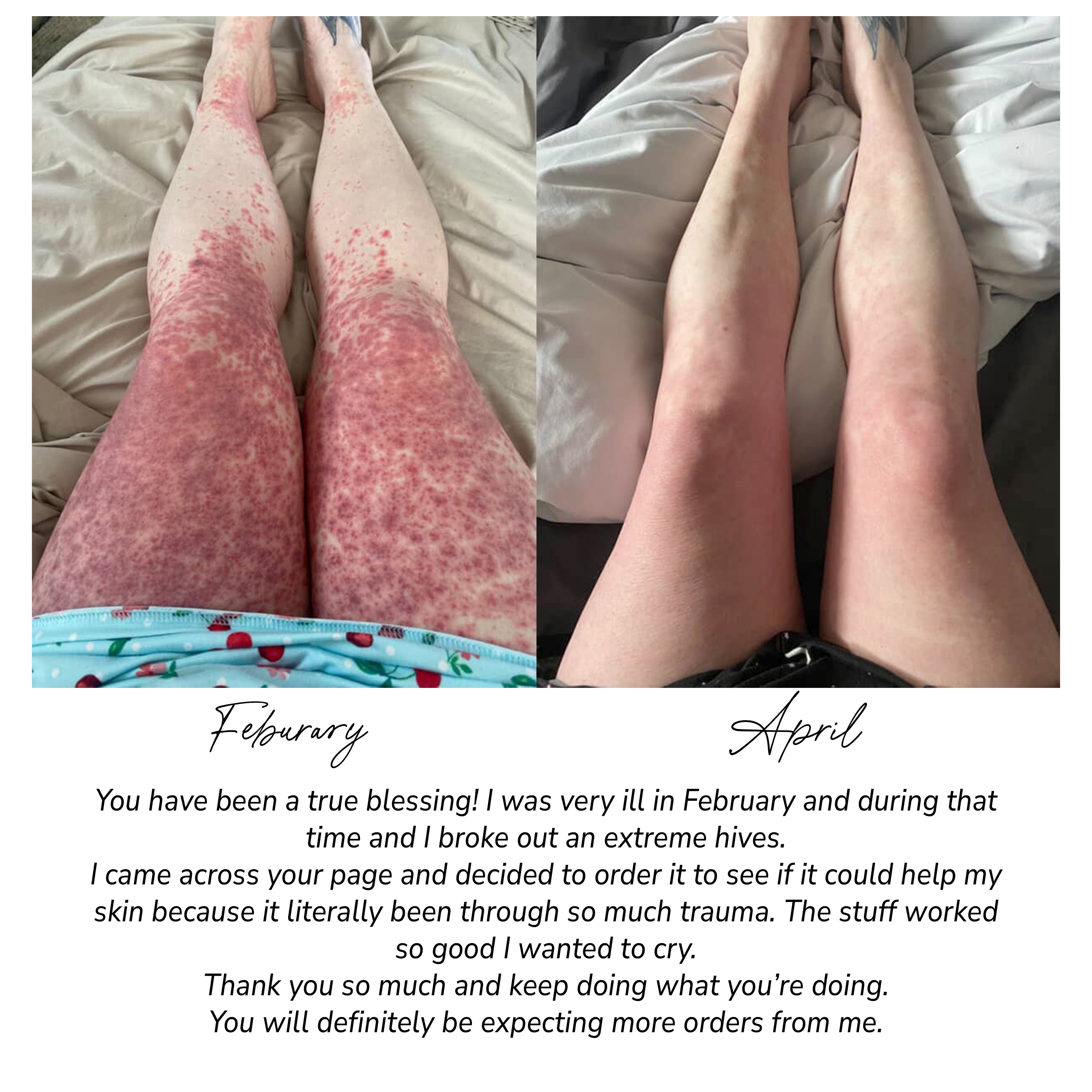 Fragrance Free Tallow + Honey Cream for Sensitive Skin - The Peony Haus