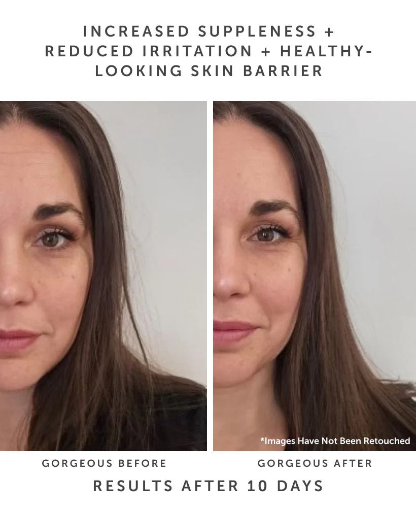 HORIZON Ceramide Recovery Serum - The Peony Haus