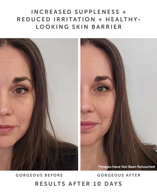 HORIZON Ceramide Recovery Serum - The Peony Haus