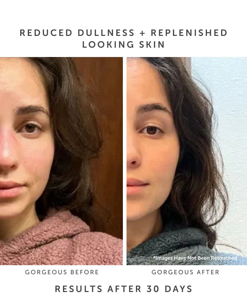 MARINA Biome Brightening Ampoule - The Peony Haus