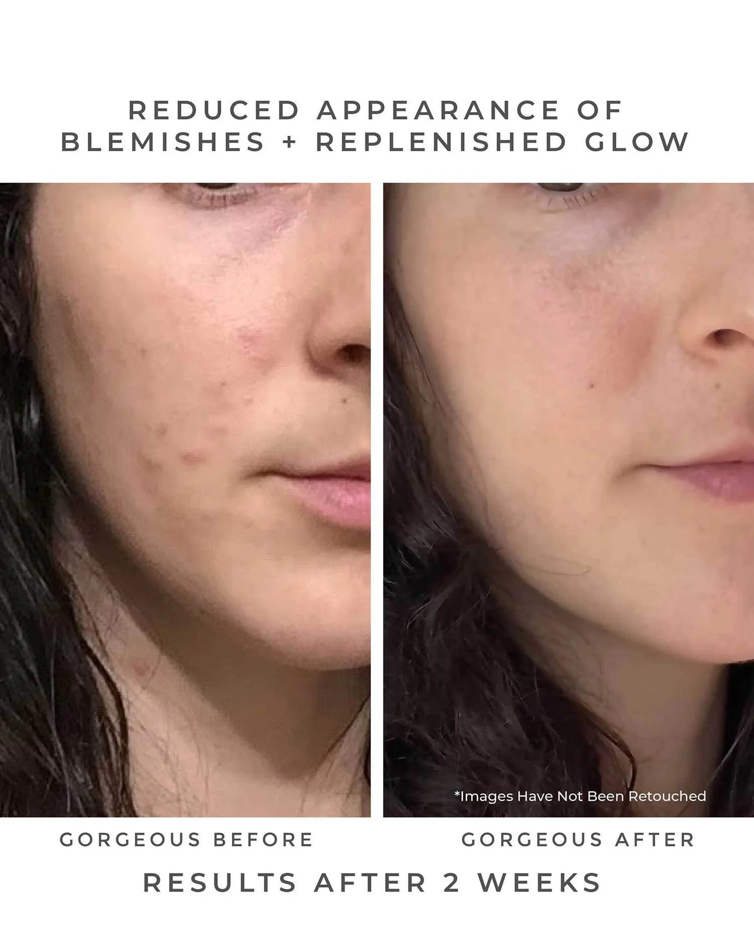 OASIS Deep Pore Gel Cleanser - The Peony Haus