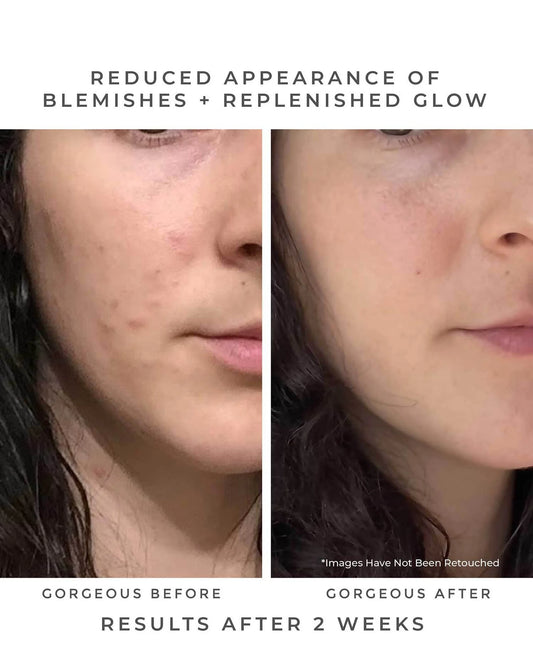 OASIS Deep Pore Gel Cleanser - The Peony Haus