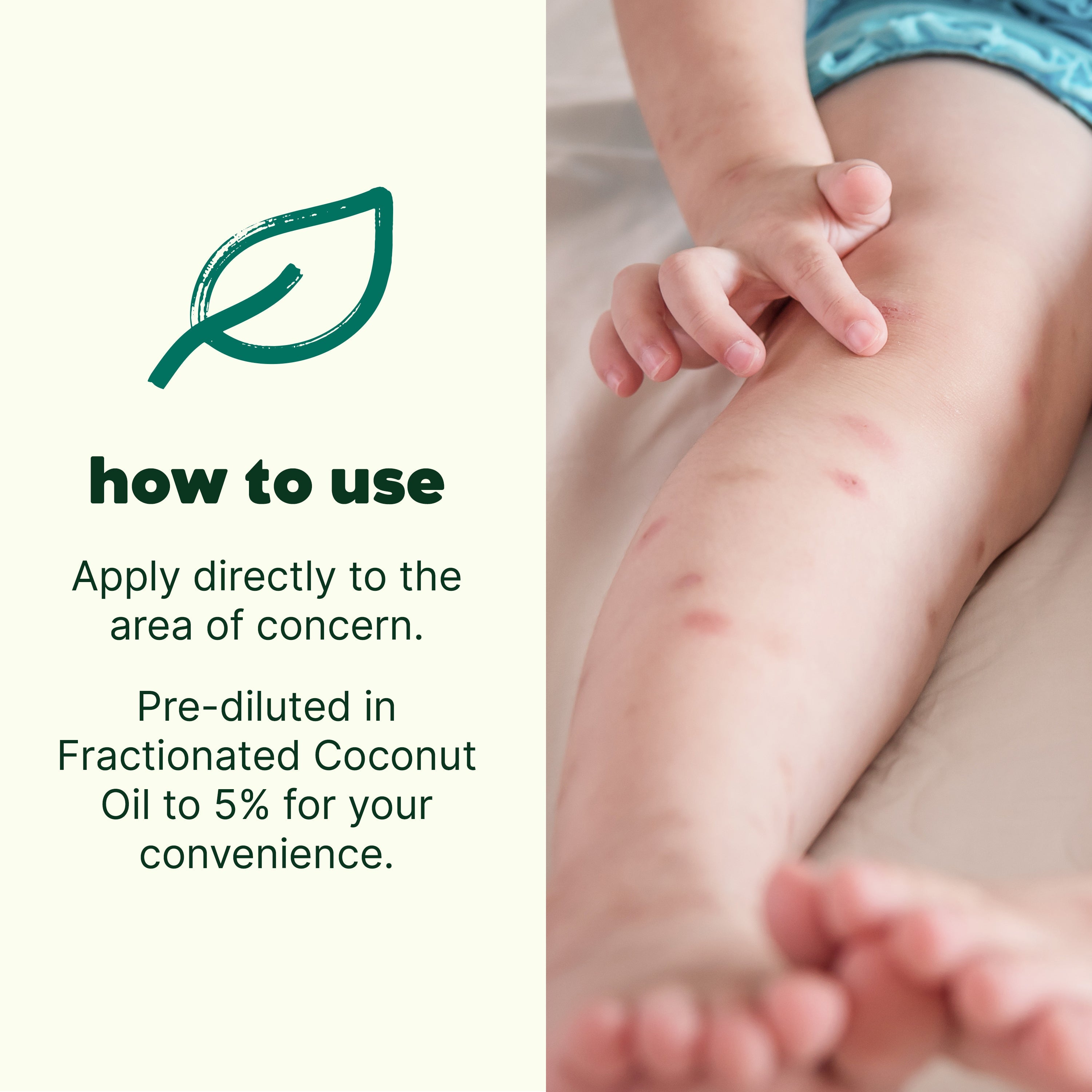 Itch Away KidSafe Essential Oil Pre-Diluted Roll-On